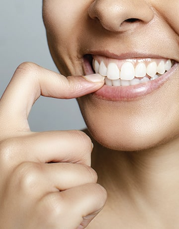 women showing white teeth