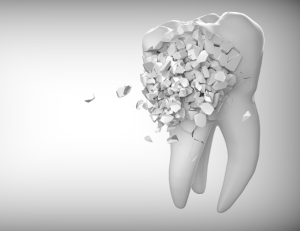 Painless Peptide Teeth Repair