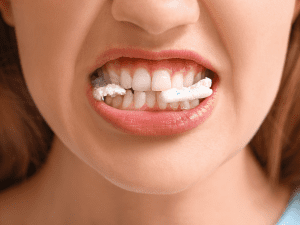 healthy gums