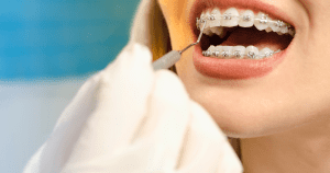 AGRP Dental Care Peptide